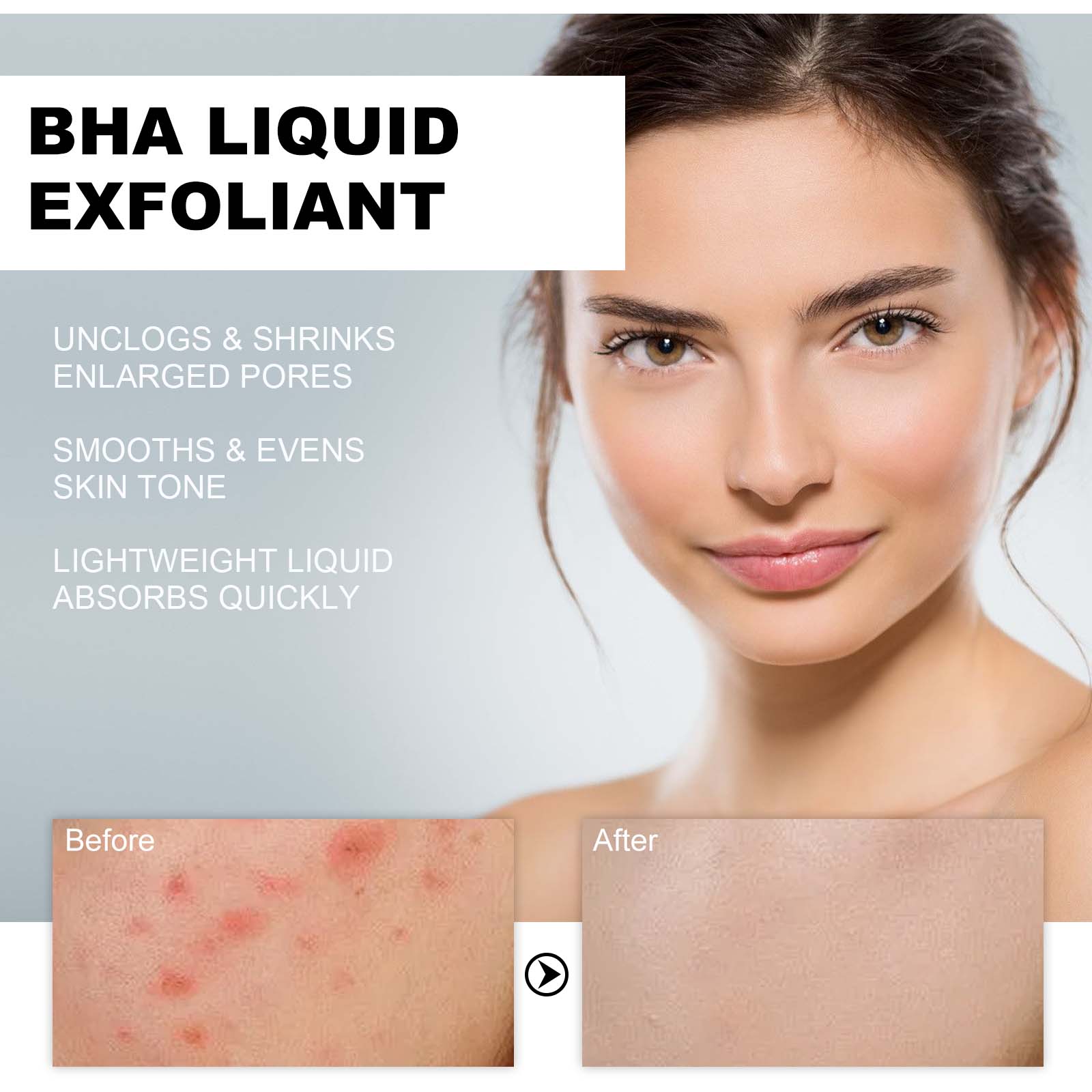 2% Salicylic Acid Liquid Exfol - Glycolic Acid Exfoliant 评论和价格