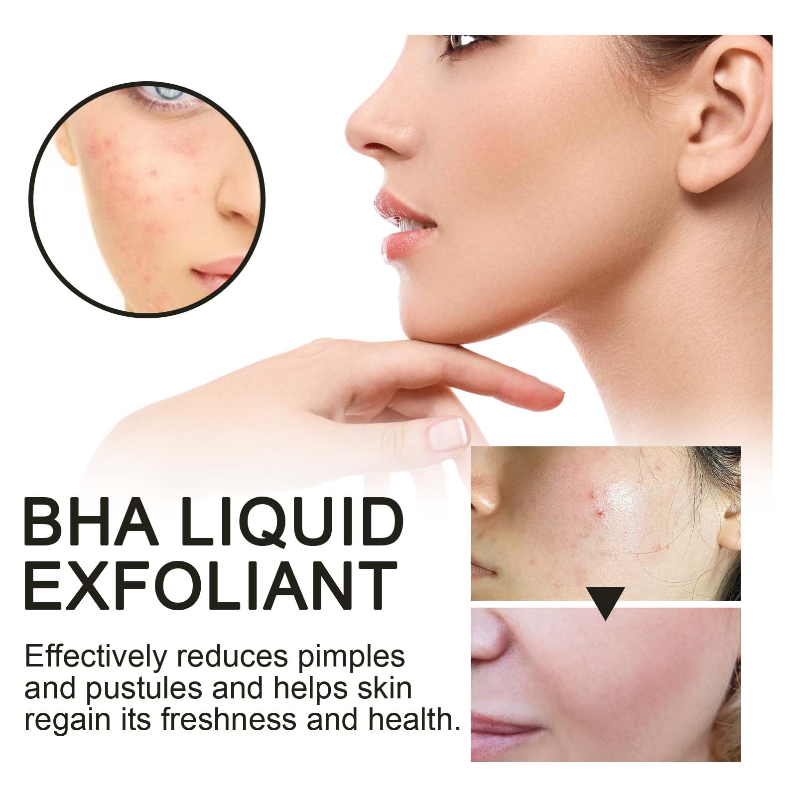 2% Salicylic Acid Liquid Exfol - Glycolic Acid Exfoliant 评论和价格